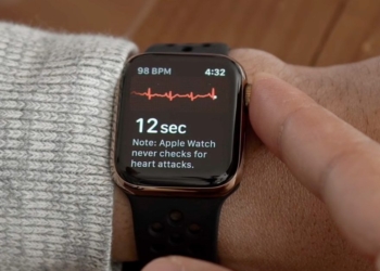 Comment l&rsquo;Apple Watch a failli me sauver la vie : mon incroyable histoire!
