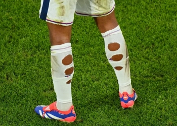 Footballeurs aux chaussettes trouées : découvrez la surprenante vérité derrière ce phénomène !