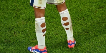 Footballeurs aux chaussettes trouées : découvrez la surprenante vérité derrière ce phénomène !