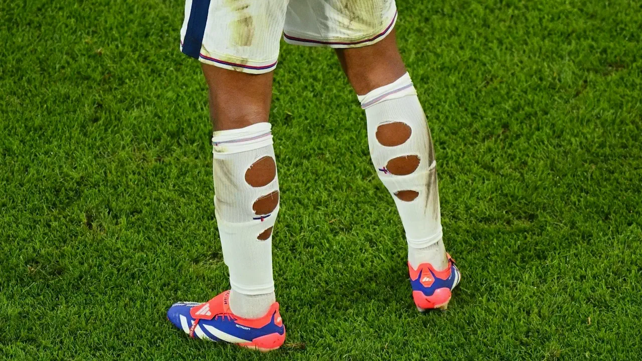 Footballeurs aux chaussettes trouées : découvrez la surprenante vérité derrière ce phénomène !
